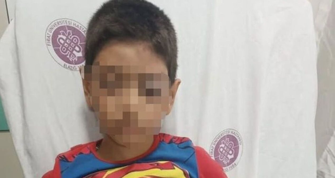 ogluyla tartisan cocuga fiziksel siddet uygulayan polis gorevinden uzaklastirildi 3hWPe6tR