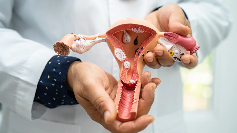 uzmani anlatti her on kadindan birinde polikistik over sendromu gorulebilir rmQUQtni